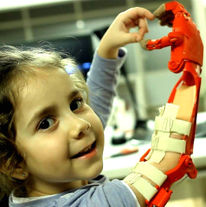 Robo hand through communal 3D printing