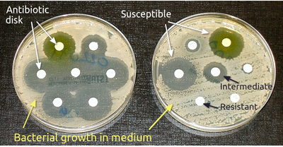 Antibiotic Susceptibility Testing AST in Bika Open Source LIMS